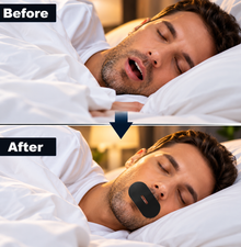 SleepSeal™ Gentle Mouth Patches – 30 Pack